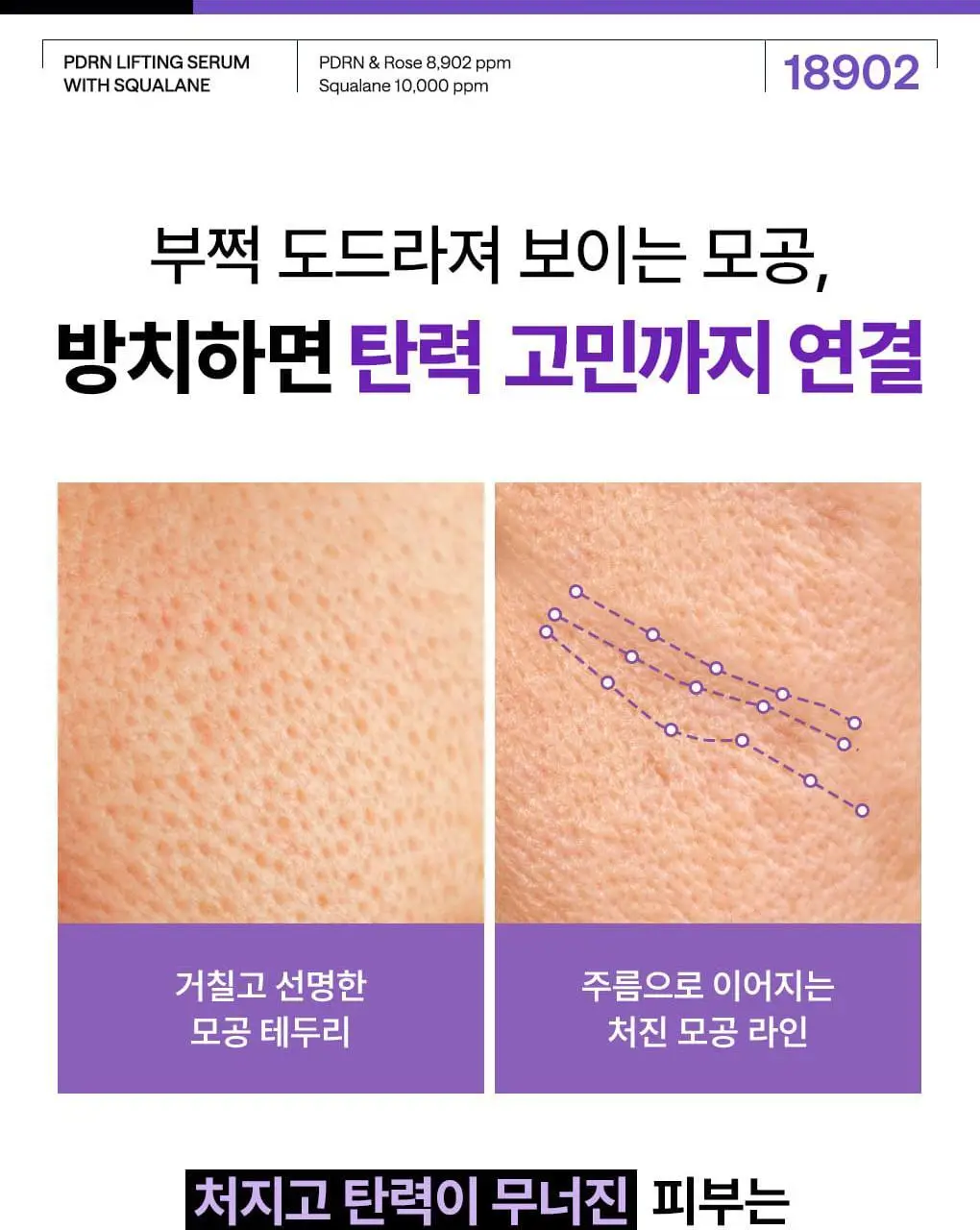 [장도연 PICK] 메디힐 PDRN 모공 탄력 세럼 40+40ml 더블 기획 상세페이지 10